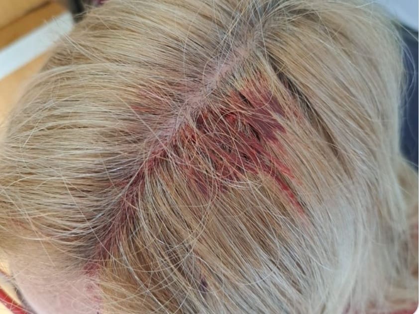 Violento intento de robo: Motochorros arrastran a una mujer veinte metros en Gascón y La Rioja 1 Screenshot 2023 09 26 13 41 10 721 com.android.chrome 01